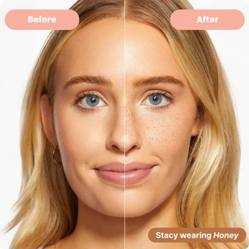 Vera™ Freckle Stamp